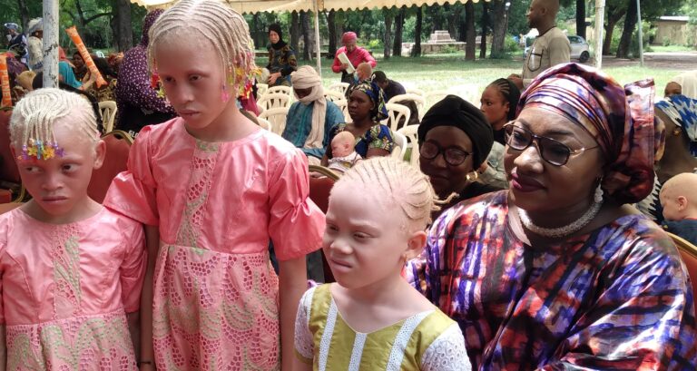 Neuvième édition de la Internationale de sensibilisation à l’albinisme: Madame Ballo Assitan Soumaoro promet une formation massive aux femmes et jeunes atteints d’albinisme